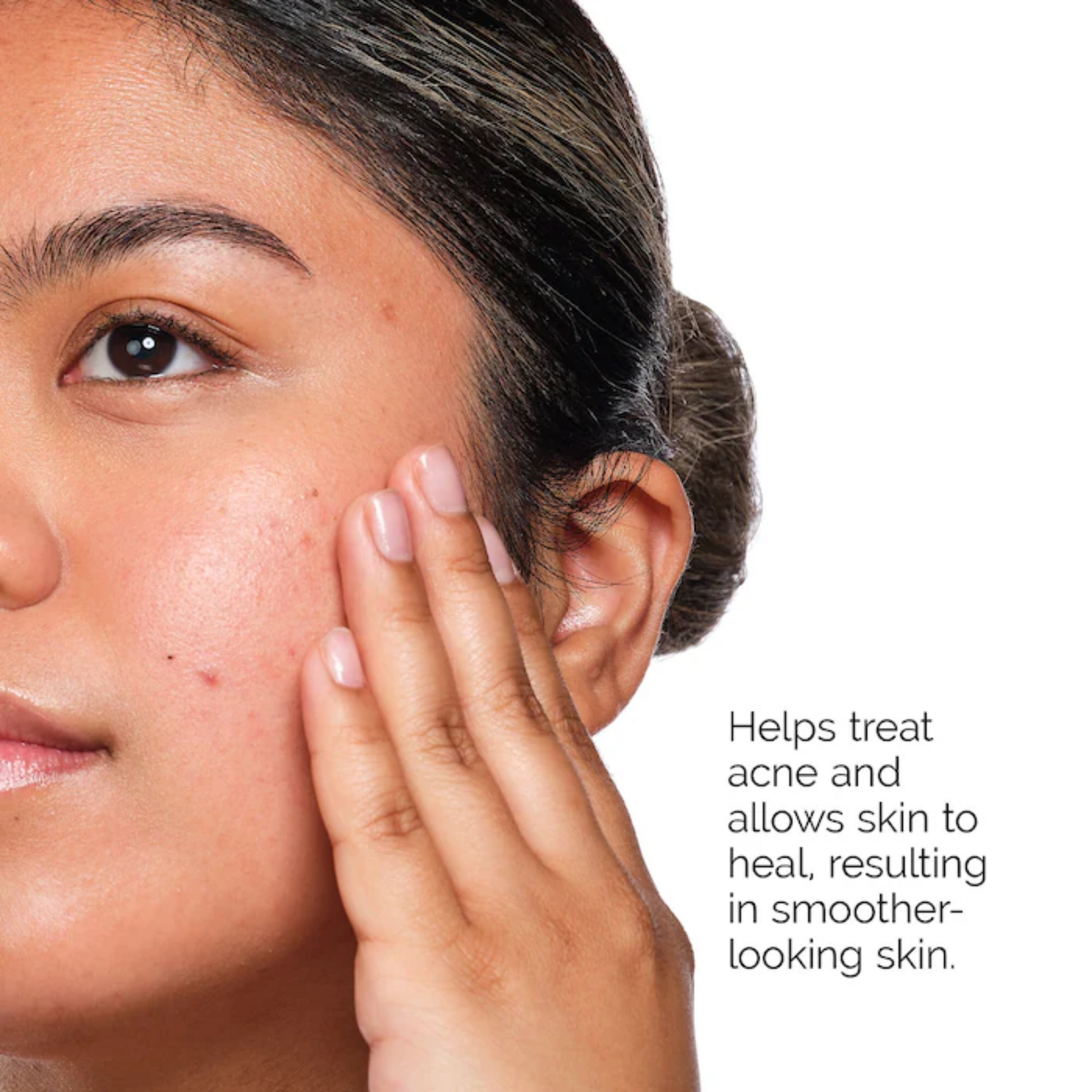 Набор для ухода The Ordinary The Acne Set The Ordinary